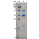 SDS-PAGE - Recombinant Human TSLP Protein (Fc Tag) (A318105) - Antibodies.com