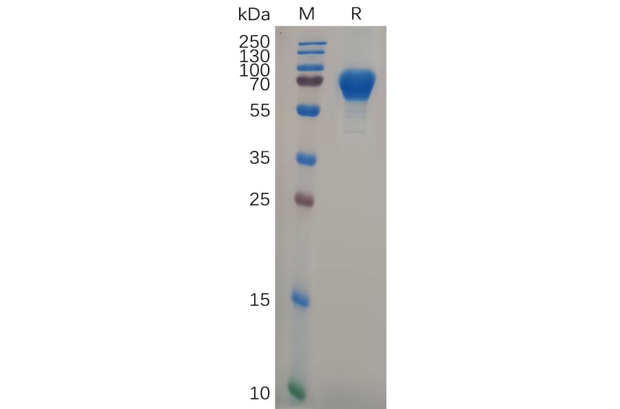 SDS-PAGE - Recombinant Human GPVI Protein (Fc Tag) (A318106) - Antibodies.com