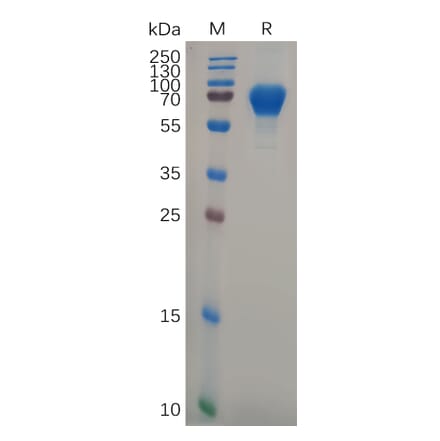 SDS-PAGE - Recombinant Human GPVI Protein (Fc Tag) (A318106) - Antibodies.com