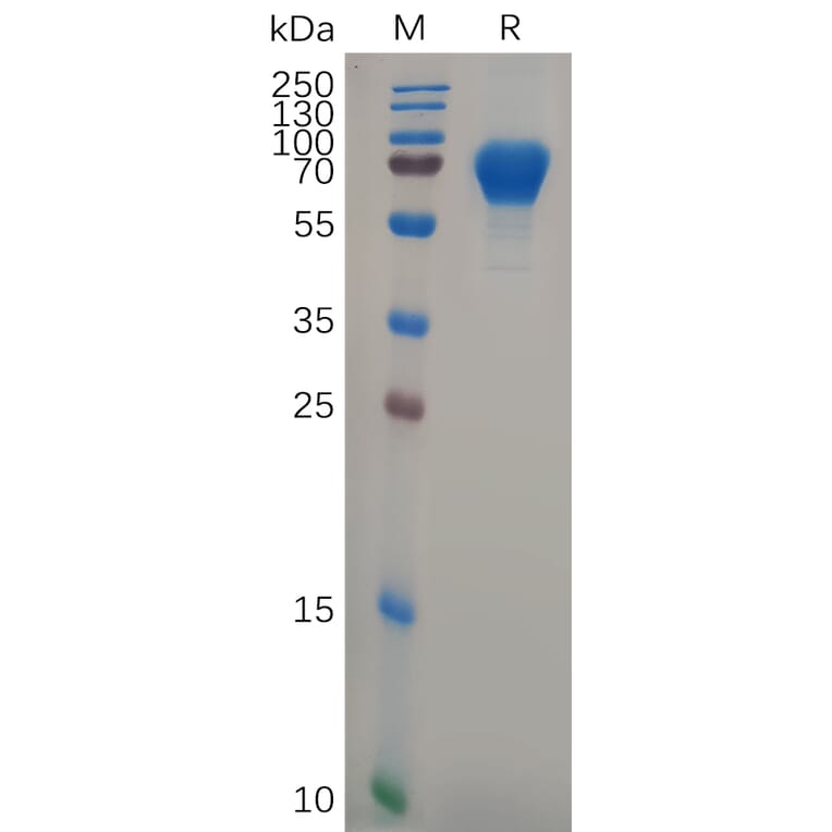 SDS-PAGE - Recombinant Human GPVI Protein (Fc Tag) (A318106) - Antibodies.com