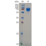 SDS-PAGE - Recombinant Human GPVI Protein (Fc Tag) (A318106) - Antibodies.com