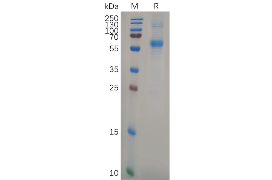 SDS-PAGE - Recombinant Human APCDD1 Protein (6×His Tag) (A318107) - Antibodies.com