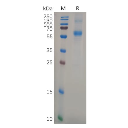 SDS-PAGE - Recombinant Human APCDD1 Protein (6×His Tag) (A318107) - Antibodies.com