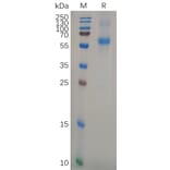 SDS-PAGE - Recombinant Human APCDD1 Protein (6×His Tag) (A318107) - Antibodies.com