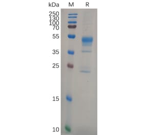 SDS-PAGE - Recombinant Human MMP9 Protein (6×His Tag) (A318108) - Antibodies.com