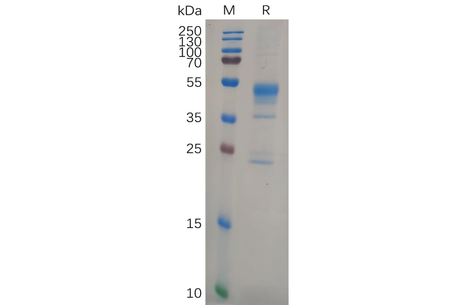 SDS-PAGE - Recombinant Human MMP9 Protein (6×His Tag) (A318108) - Antibodies.com