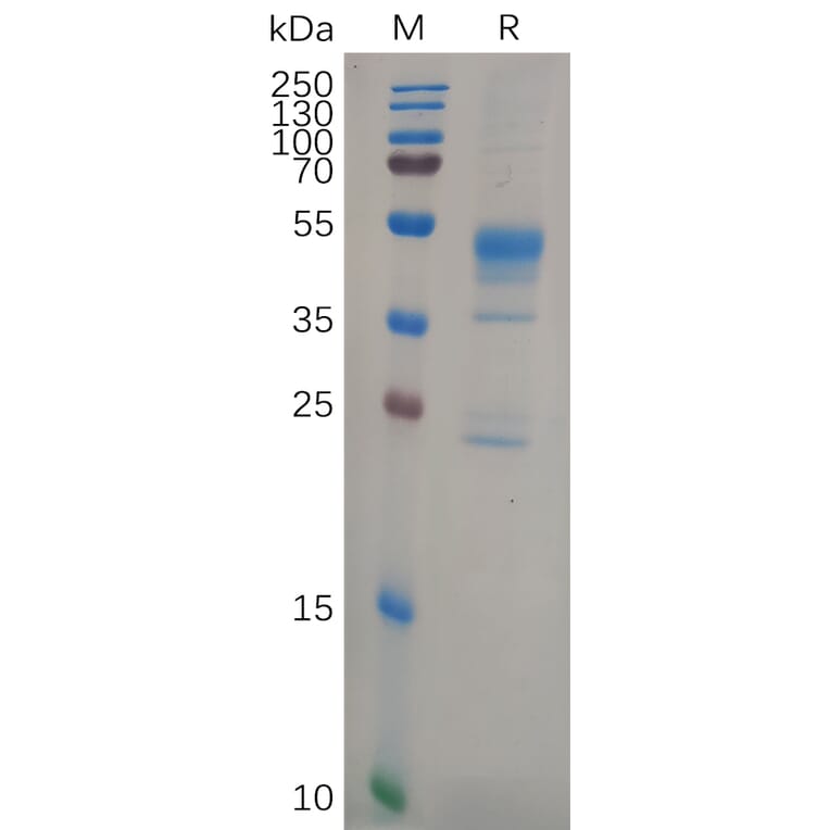 SDS-PAGE - Recombinant Human MMP9 Protein (6×His Tag) (A318108) - Antibodies.com