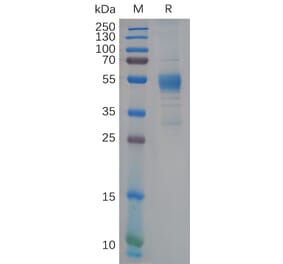 SDS-PAGE - Recombinant Human TREM2 Protein (Fc Tag) (A318109) - Antibodies.com