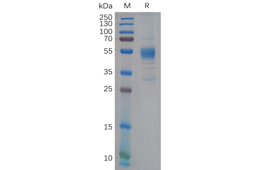 SDS-PAGE - Recombinant Human TREM2 Protein (Fc Tag) (A318109) - Antibodies.com