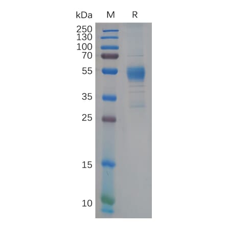 SDS-PAGE - Recombinant Human TREM2 Protein (Fc Tag) (A318109) - Antibodies.com