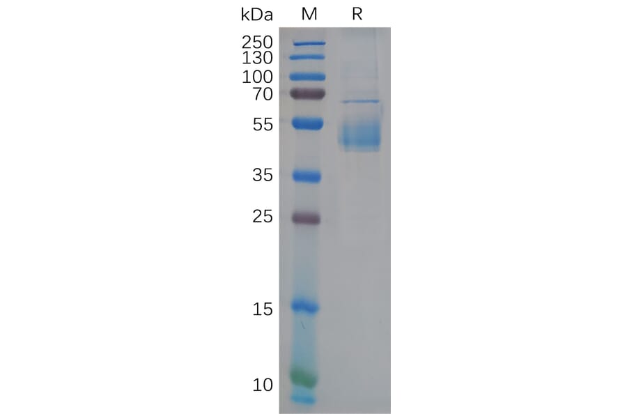SDS-PAGE - Recombinant Human CD42c/GP1BB Protein (Fc Tag) (A318110) - Antibodies.com