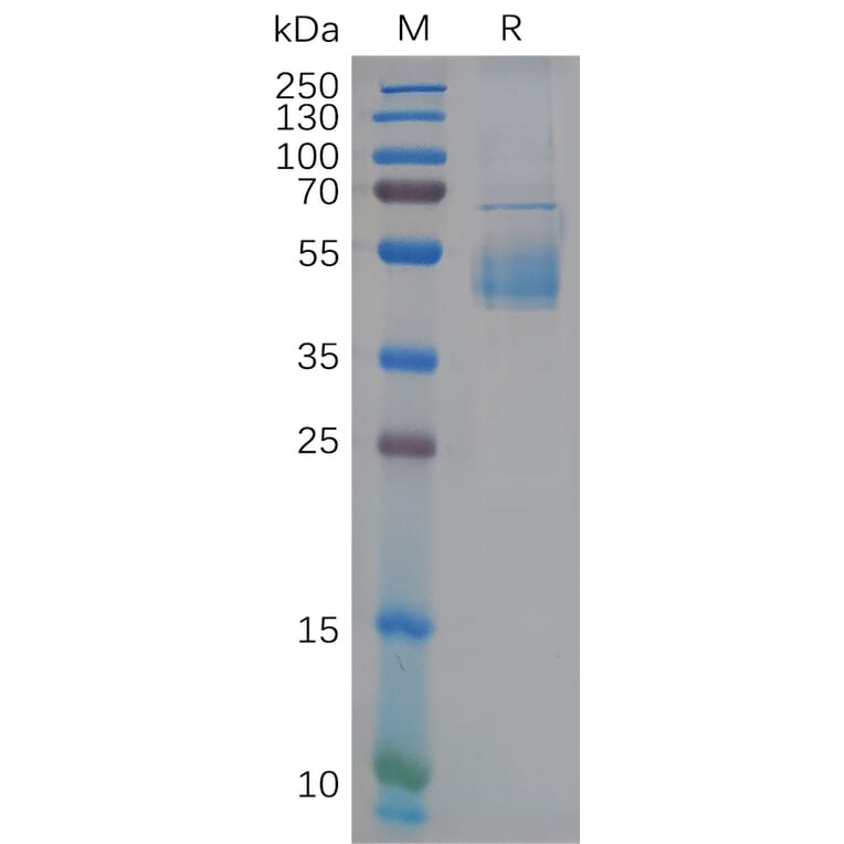 SDS-PAGE - Recombinant Human CD42c/GP1BB Protein (Fc Tag) (A318110) - Antibodies.com