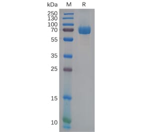 SDS-PAGE - Recombinant Human Eph Receptor B2 Protein (6×His Tag) (A318111) - Antibodies.com