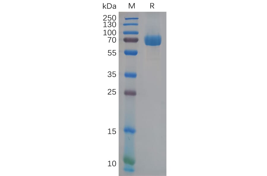 SDS-PAGE - Recombinant Human Eph Receptor B2 Protein (6×His Tag) (A318111) - Antibodies.com