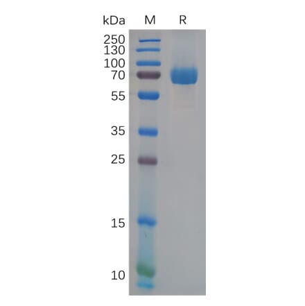 SDS-PAGE - Recombinant Human Eph Receptor B2 Protein (6×His Tag) (A318111) - Antibodies.com