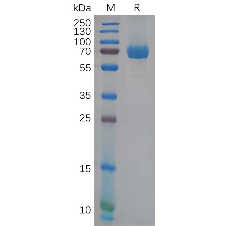 SDS-PAGE - Recombinant Human Eph Receptor B2 Protein (6×His Tag) (A318111) - Antibodies.com