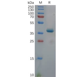SDS-PAGE - Recombinant Human ROR1 Protein (Fc Tag) (A318112) - Antibodies.com
