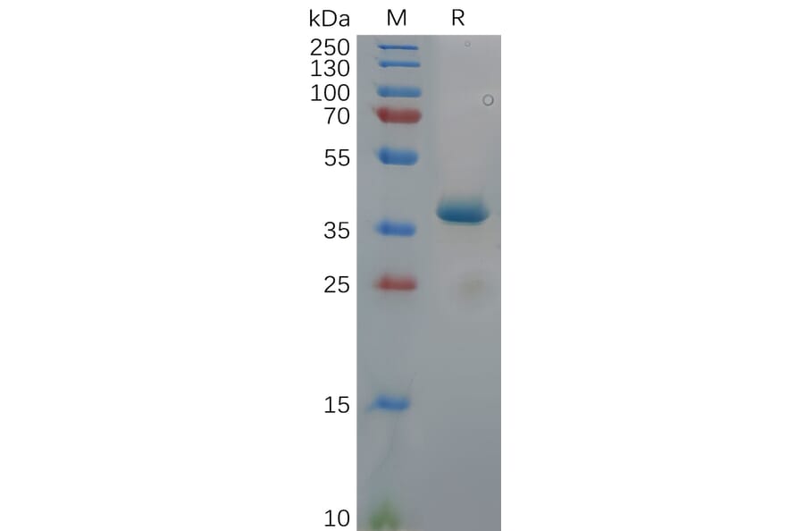 SDS-PAGE - Recombinant Human ROR1 Protein (Fc Tag) (A318112) - Antibodies.com