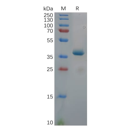 SDS-PAGE - Recombinant Human ROR1 Protein (Fc Tag) (A318112) - Antibodies.com