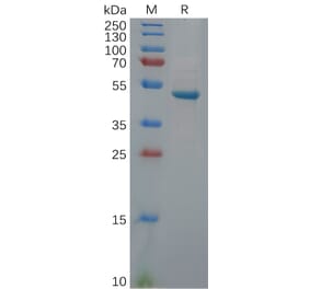 SDS-PAGE - Recombinant Human PGP9.5 Protein (Fc Tag) (A318113) - Antibodies.com