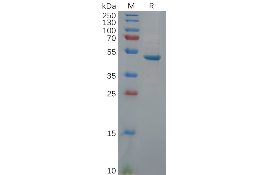 SDS-PAGE - Recombinant Human PGP9.5 Protein (Fc Tag) (A318113) - Antibodies.com