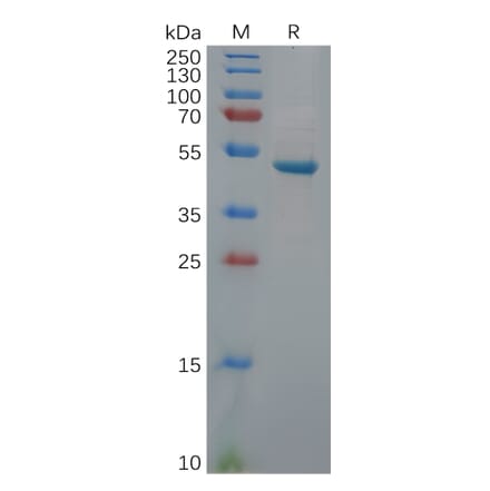 SDS-PAGE - Recombinant Human PGP9.5 Protein (Fc Tag) (A318113) - Antibodies.com