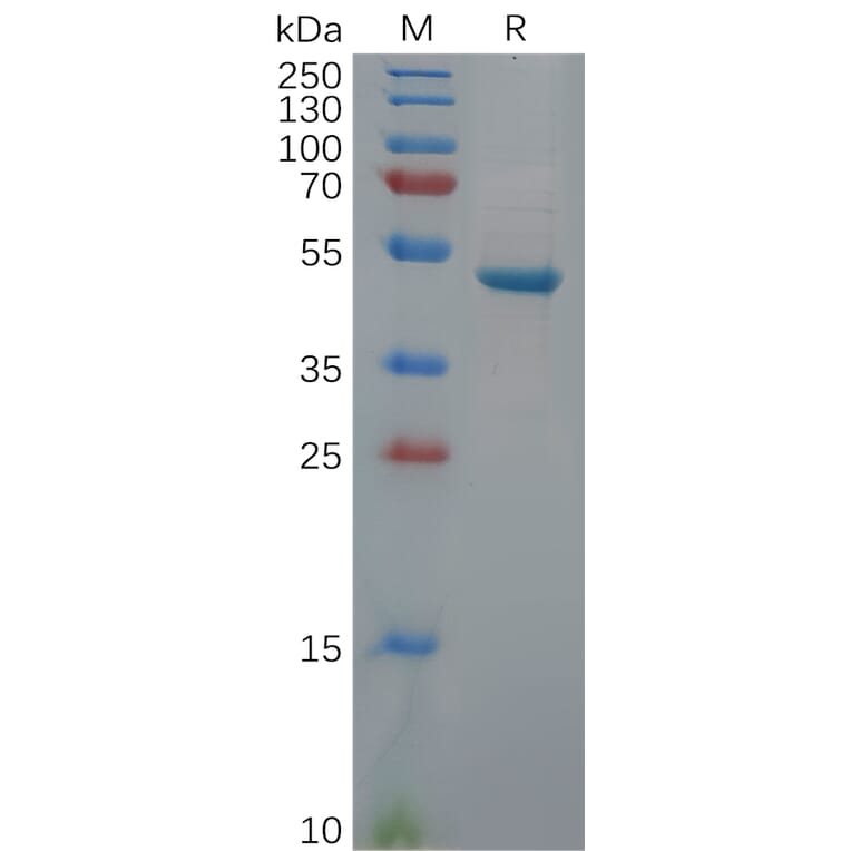 SDS-PAGE - Recombinant Human PGP9.5 Protein (Fc Tag) (A318113) - Antibodies.com