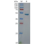 SDS-PAGE - Recombinant Human PGP9.5 Protein (Fc Tag) (A318113) - Antibodies.com