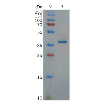 SDS-PAGE - Recombinant Human GDF15 Protein (Fc Tag) (A318114) - Antibodies.com