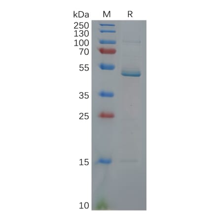SDS-PAGE - Recombinant Human IL-17C Protein (Fc Tag) (A318115) - Antibodies.com