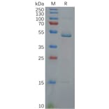 SDS-PAGE - Recombinant Human IL-17C Protein (Fc Tag) (A318115) - Antibodies.com