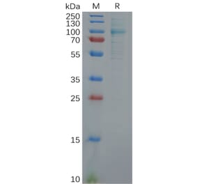 SDS-PAGE - Recombinant Human Fibroblast Activation Protein alpha Protein (6×His Tag) (A318116) - Antibodies.com