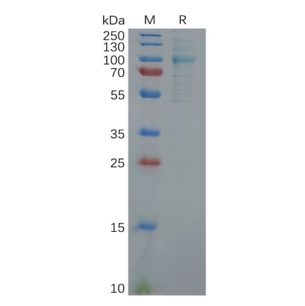 SDS-PAGE - Recombinant Human Fibroblast Activation Protein alpha Protein (6×His Tag) (A318116) - Antibodies.com
