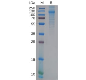 SDS-PAGE - Recombinant human FcRL5 Protein (6×His Tag) (A318117) - Antibodies.com