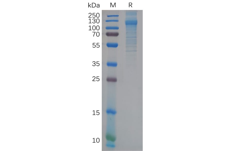 SDS-PAGE - Recombinant human FcRL5 Protein (6×His Tag) (A318117) - Antibodies.com