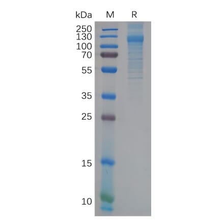 SDS-PAGE - Recombinant human FcRL5 Protein (6×His Tag) (A318117) - Antibodies.com