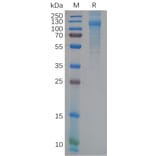 SDS-PAGE - Recombinant human FcRL5 Protein (6×His Tag) (A318117) - Antibodies.com