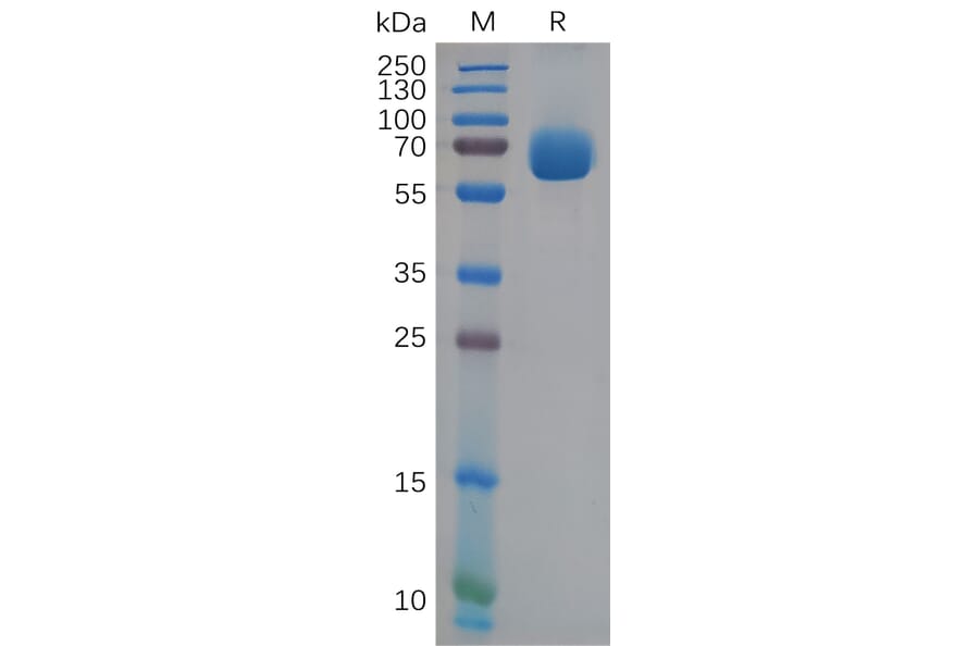 SDS-PAGE - Recombinant Human Eph Receptor A4/SEK Protein (6×His Tag) (A318118) - Antibodies.com