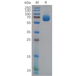 SDS-PAGE - Recombinant Human Eph Receptor A4/SEK Protein (6×His Tag) (A318118) - Antibodies.com