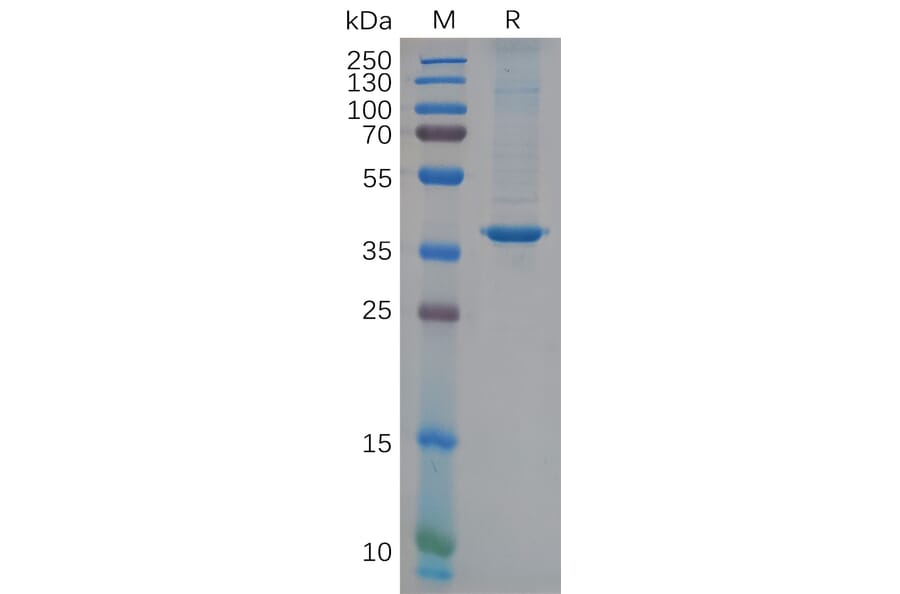 SDS-PAGE - Recombinant Human YKL-40/CHI3L1 Protein (6×His Tag) (A318119) - Antibodies.com