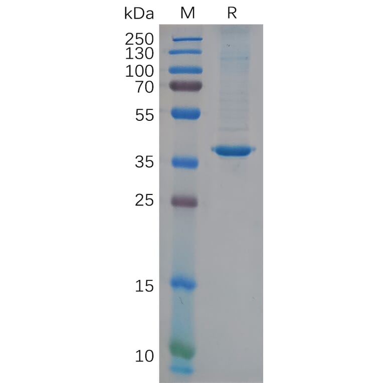 SDS-PAGE - Recombinant Human YKL-40/CHI3L1 Protein (6×His Tag) (A318119) - Antibodies.com