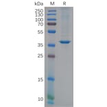 SDS-PAGE - Recombinant Human YKL-40/CHI3L1 Protein (6×His Tag) (A318119) - Antibodies.com