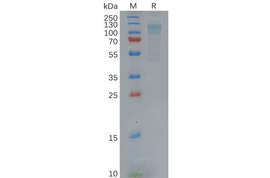 SDS-PAGE - Recombinant Human EMR1/ADGRE1 Protein (6×His Tag) (A318120) - Antibodies.com