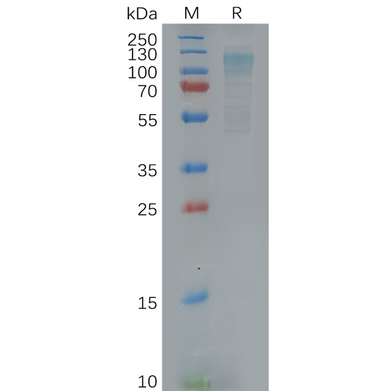SDS-PAGE - Recombinant Human EMR1/ADGRE1 Protein (6×His Tag) (A318120) - Antibodies.com