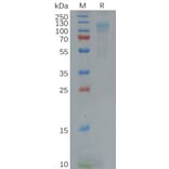 SDS-PAGE - Recombinant Human EMR1/ADGRE1 Protein (6×His Tag) (A318120) - Antibodies.com