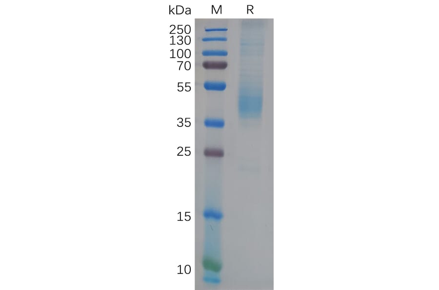 SDS-PAGE - Recombinant Human GFRAL Protein (6×His Tag) (A318121) - Antibodies.com