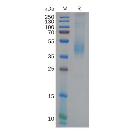 SDS-PAGE - Recombinant Human GFRAL Protein (6×His Tag) (A318121) - Antibodies.com