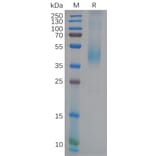 SDS-PAGE - Recombinant Human GFRAL Protein (6×His Tag) (A318121) - Antibodies.com