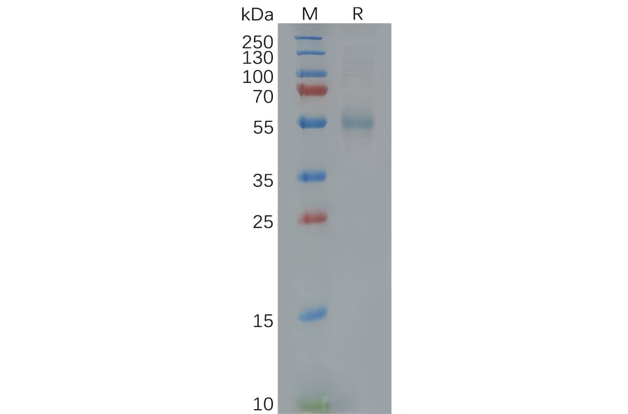 SDS-PAGE - Recombinant Human GFR alpha 3/GFRA3 Protein (6×His Tag) (A318122) - Antibodies.com