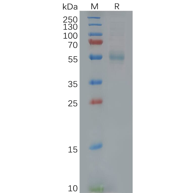 SDS-PAGE - Recombinant Human GFR alpha 3/GFRA3 Protein (6×His Tag) (A318122) - Antibodies.com